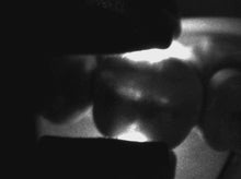 Load image into Gallery viewer, Dexis CariVu Dental Carious Legion Detection System
