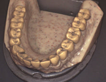 Load image into Gallery viewer, Digital Doc Iris X80 Dental Intraoral Camera Imaging Unit
