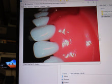 Load image into Gallery viewer, Digi Doc (Digital Doc) Iris (USB 2.0) Dental Intraoral Camera Imaging System
