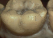 Load image into Gallery viewer, DigitalDOC Iris Dental Dentistry High Resolution Intraoral Camera
