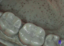 Load image into Gallery viewer, Acteon SoPro Life Dental Intraoral Camera Imaging System
