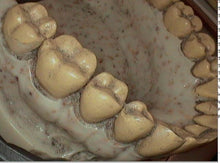 Load image into Gallery viewer, DigitalDOC Iris Dental Dentistry Intraoral Camera Imaging Device
