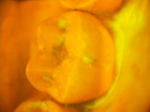 Load image into Gallery viewer, Air Techniques Spectra Dental Intraoral Camera Imaging System
