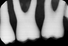Load image into Gallery viewer, Gendex GXS-700 Dental Digital Sensor Size 1
