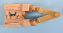 Load image into Gallery viewer, NEW UNUSED Planmeca Emerald S Dental Intraoral Scanner for CAD/CAM Dentistry
