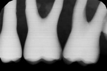 Load image into Gallery viewer, Gendex GXS-700 Dental Digital Sensor Size 1
