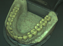 Load image into Gallery viewer, Digital Doc Iris X80 Dental Intraoral Camera Imaging System
