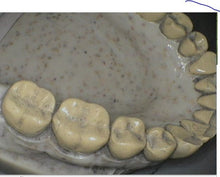 Load image into Gallery viewer, Acteon SoPro 717 Dental Intraoral Camera Imaging System
