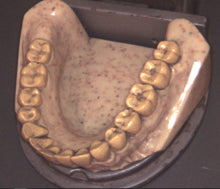 Load image into Gallery viewer, Digital Doc Iris X80 Intraoral Dental Intraoral Camera Imaging System
