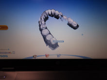 Load image into Gallery viewer, Planmeca PlanScan Dental Intraoral Scanner for CAD/CAM Dentistry
