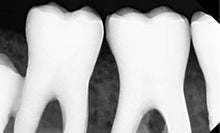 Load image into Gallery viewer, Digital Doc Blu Dental Digital Sensor Size 1
