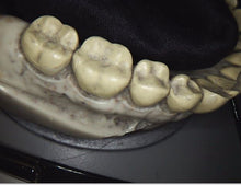 Load image into Gallery viewer, Carestream CS1500 Wireless Dental Intraoral Camera Imaging System (2021)
