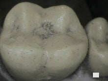 Load image into Gallery viewer, Acteon SoPro Care Dental Intraoral Camera Imaging Unit
