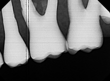 Load image into Gallery viewer, Dexis Platinum PLU 690 Dental Intraoral X-Ray Sensor- FOR PARTS/REPAIR
